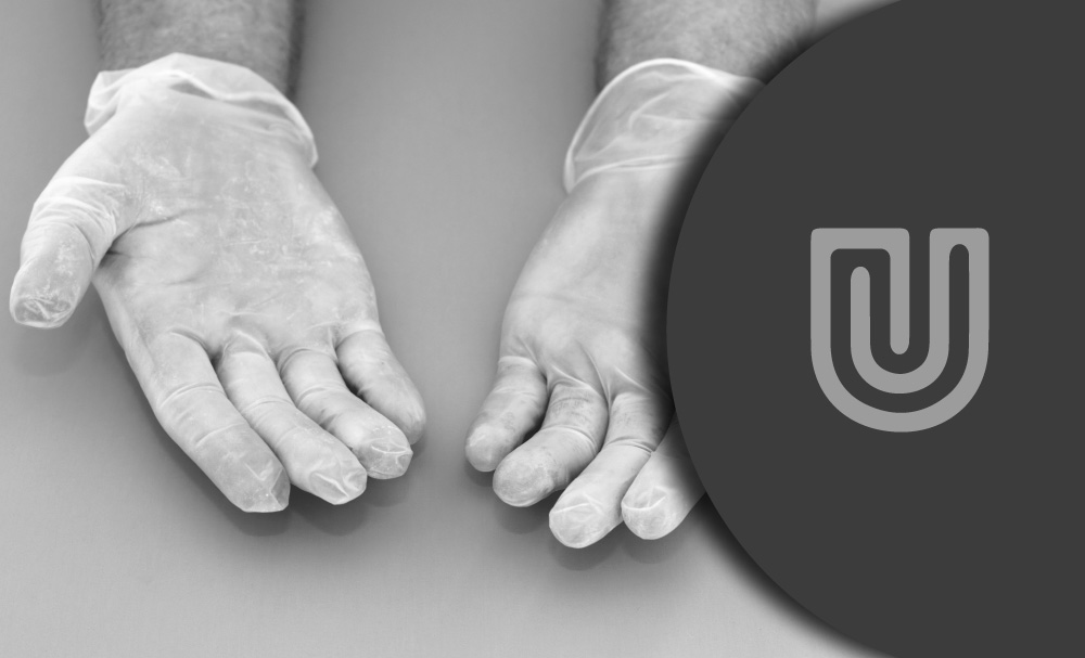 How Likely is an Allergic Reaction to Vinyl Gloves? Unigloves